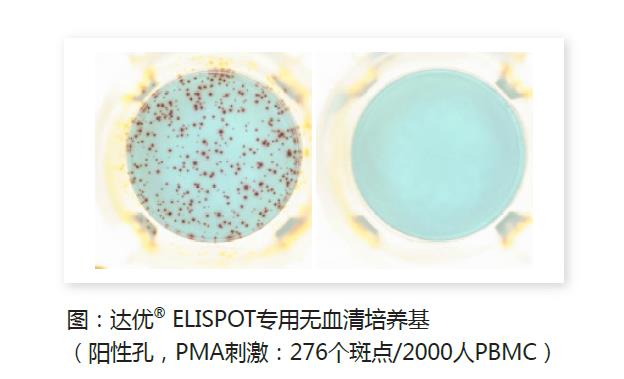 人淋巴细胞无血清培养基-斑点1.jpg